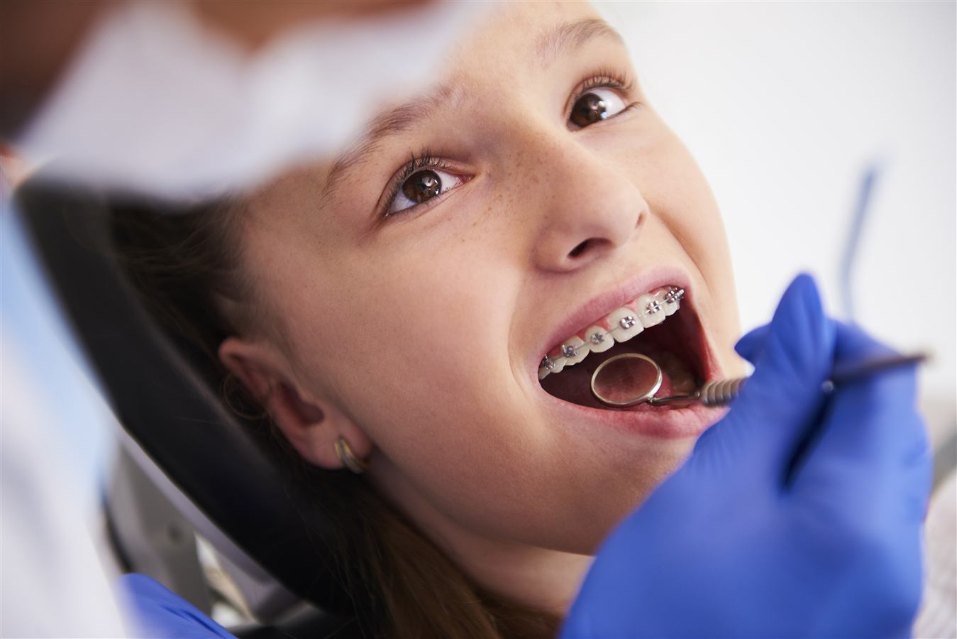 Braces at Caring Dental of Herndon