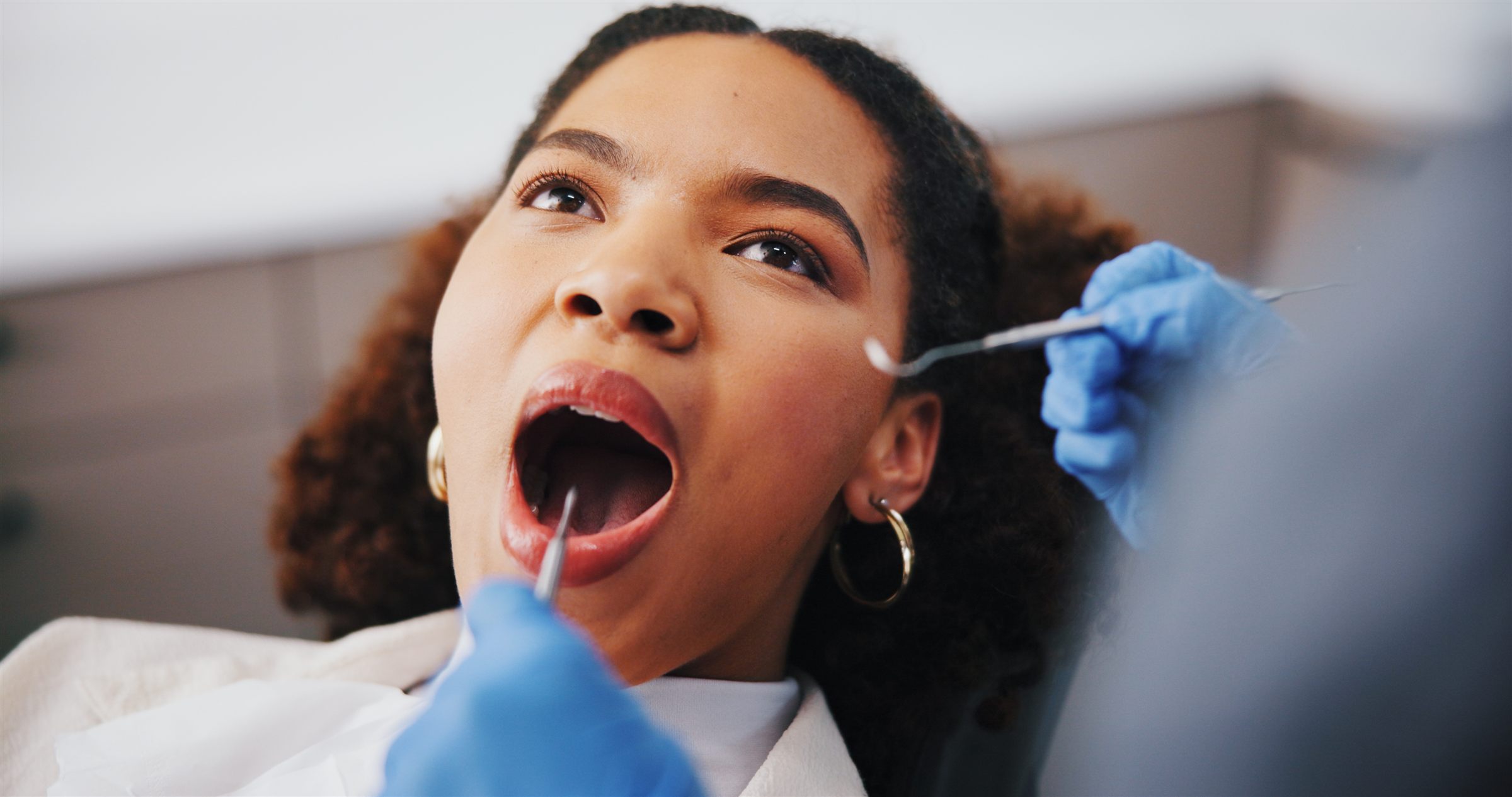 Dental Filling at Caring Dental of Herndon